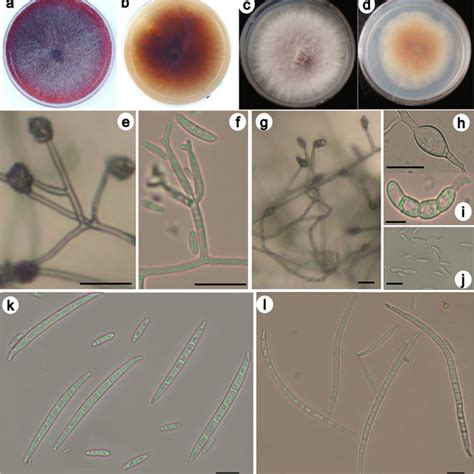 The Secondary Metabolite Content Of The Endophytic Fungi Species Liquid