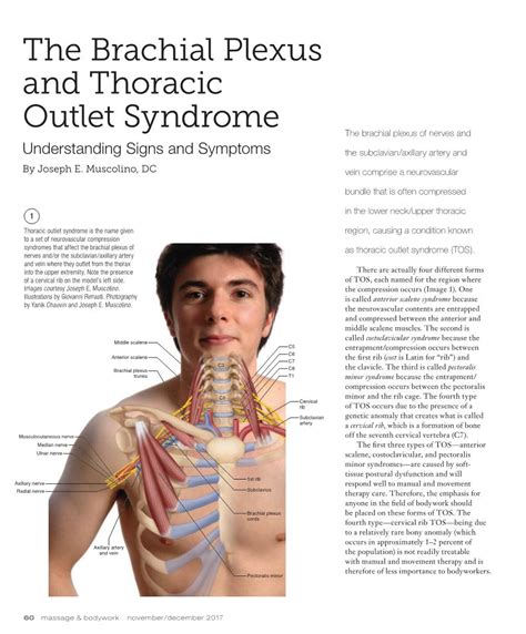 The Brachial Plexus And Thoracic Outlet Syndrome The Brachial Plexus Of