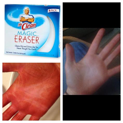 Get Rid Of A Bad Spray Tan On Your Hands By Scrubbing Them With A Mr