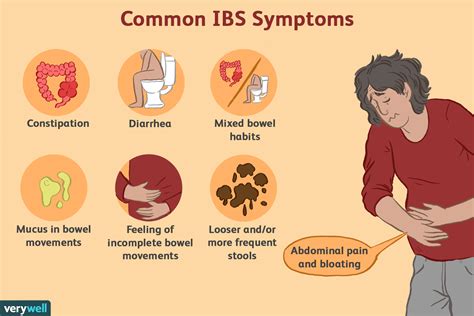 Irritable Bowel Syndrome Symptoms