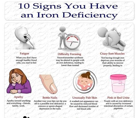 10 Signs You Have An Iron Deficiency Visually Здоровье