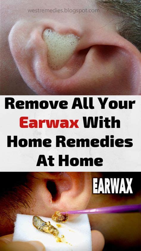 Sports Discover Remove All Your Earwax With Home Remedies At Home Pin 4 Health Cleaning Your
