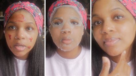 Use a sunscreen, wear protective clothing, and limit sun exposure while using this product and for a week afterwards. My Triple Face Mask Routine With The Ordinary AHA 30% ...