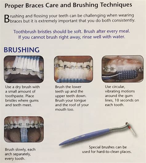 Here are some tips you can use to however, it is an extremely important part of your oral hygiene routine. Brushing and Flossing with Braces | Central Orthodontics