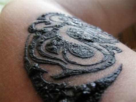 Do not mock a person's appearance or tattoo. Tattoo bubbling happens during the healing process & can ...