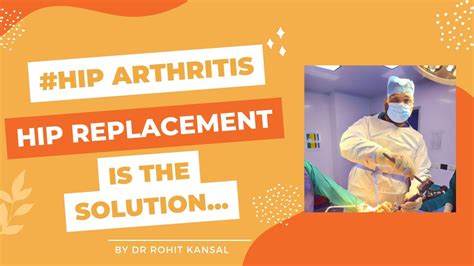 Total Hip Replacement For Hip Arthritis Youtube