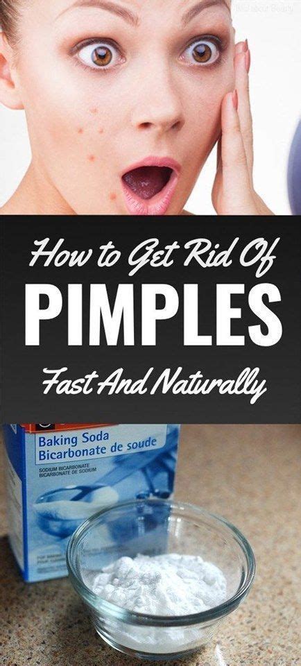 How To Get Rid Of Pimples Fast In 2020 How To Get Rid Of Pimples