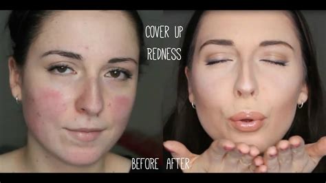 Make Up Tutorial For Rosacea Party Camouflage Contouring Make Up