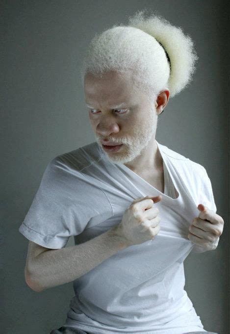 Deejay Jewell Albino Men Interesting Faces