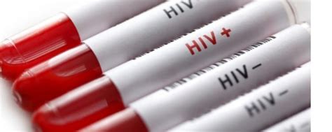 hiv outbreak in milwaukee breaks records instinct magazine
