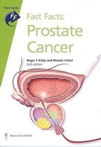 Fast Facts Prostate Cancer Buy Fast Facts Prostate Cancer By Kirby Roger S Mbbs Mmed Fracs