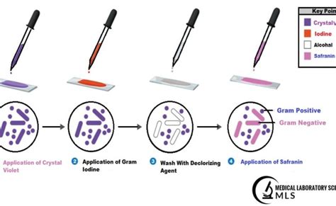 Gram Staining Principle Reagents Procedure Steps Results Otosection