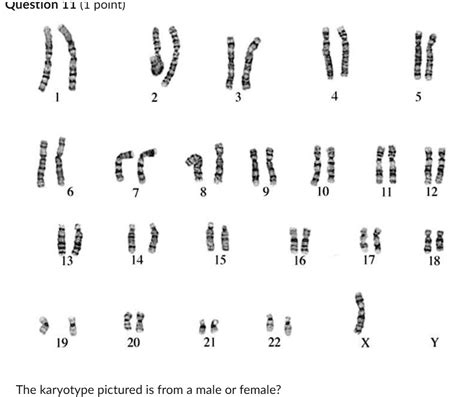 Solved A Male B Female What Is Abnormal About This Karyotype A