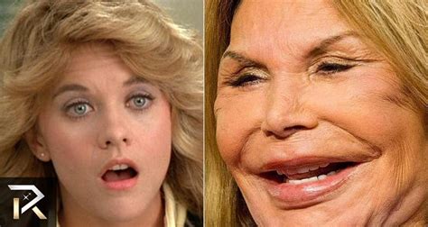 Top Famous People Who Are Unrecognizable Today After Their Surgeries Bad Celebrity Plastic