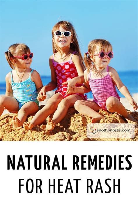 Natural Remedies For Heat Rash In Children Heat Rash Rashes In