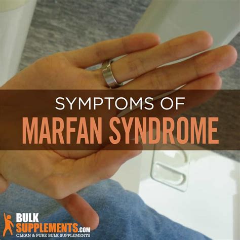 Marfan Syndrome Understanding Causes Symptoms And Treatment
