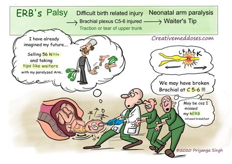 Erb S Palsy Causes Symptoms And Treatment Birth Injur