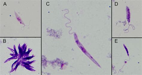 Morphological Forms Determined In Midgut Smears Leishmania Parasites Download Scientific