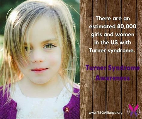 Pin By Brittany L On Quotes Turner Syndrome Turner Syndrome Awareness Chromosomal Disorders