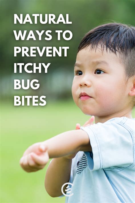 6 Natural Bug Bite Remedies Bug Bites Remedies Natural Bug Bite