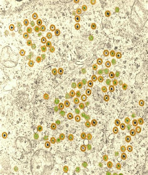 Herpes Virus Photograph By A Dowsett Public Health Englandscience