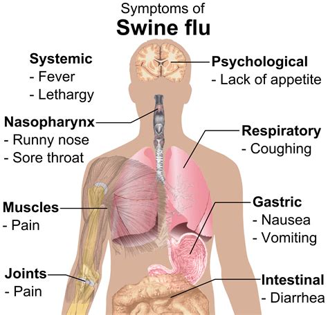 Am I Suffering From Swine Flu Dr Thind S Homeopathic Clinic