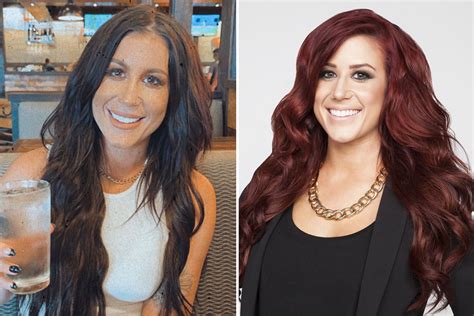 Chelsea Houska Unrecognizable By Fans After Showing Off Plastic