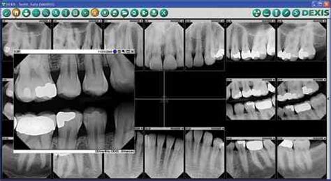 Digital X Rays Hampton Woods Dental