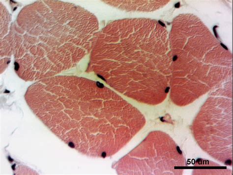 Fibras musculares estriadas esqueléticas Histología y Embriología