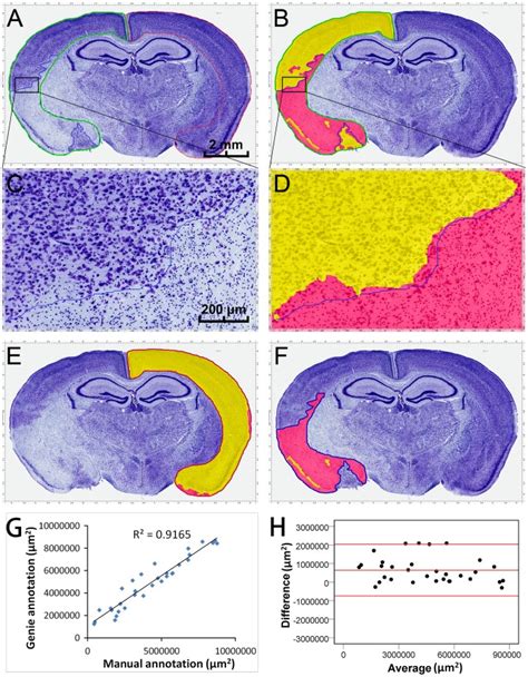 After Transient Focal Cerebral Ischemia In Mice The Cresyl Violet