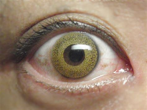 Filecolor Contact Lens Eye Brown Wikimedia Commons
