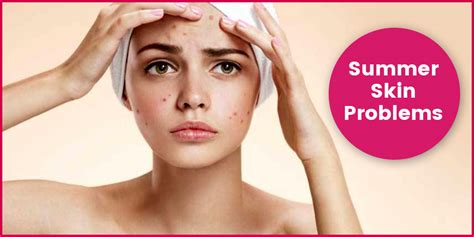 Common Skin Problems In Summers And How To Prevent Onlymyhealth
