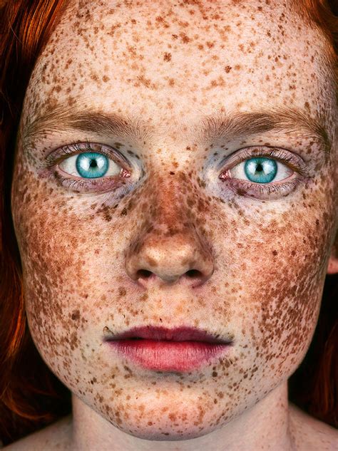 Brock Elbank The Beauty Of Freckles By Brock Elbank Art Ctrl Del