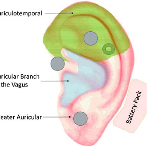 Depiction Of The Auricle Showing Nerve Distributions And Sample Nss