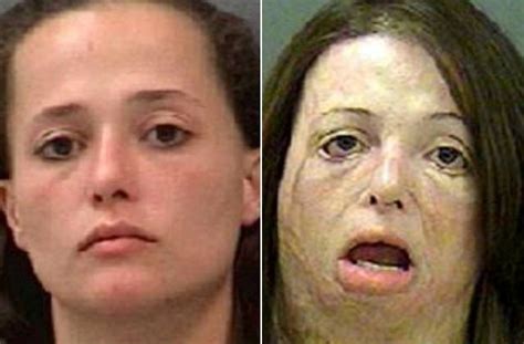People On Meth Before And After