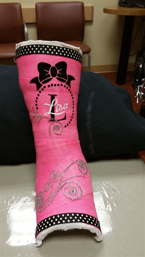 decorative leg cast | Leg cast, Cast decoration, Arm cast