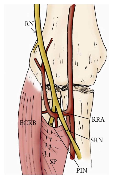 The Drawing Provides An Anterior View Of The Course Of The Radial Nerve