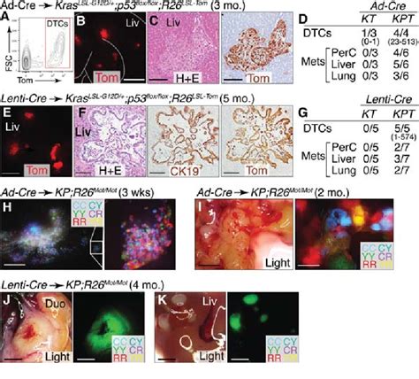 Figure 2 From Pancreatic Cancer Modeling Using Retrograde Viral Vector