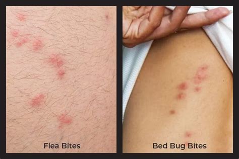 Bed Bugs Habits And Prevention Carolina Exterminating