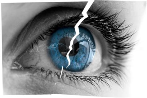 What We Still Dont Know About Lasik
