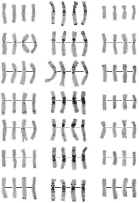 Chromosome C Banding Patterns Of The Four Alloplasmic H Vulgaret