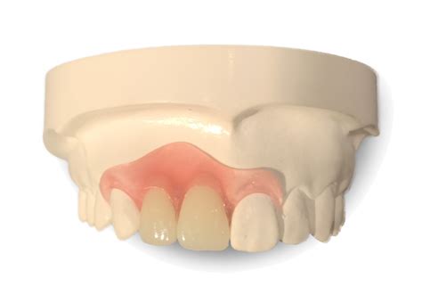 Nesbit Partial Dentures Shine Dental Associates