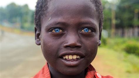 African People With Blue Eyes