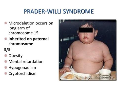 Ppt Chromosomal Abnormalities Powerpoint Presentation Id5719987