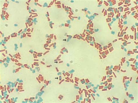Bacillus Megaterium Endospore Staining Microbiology Pinterest