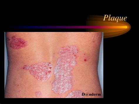 Ppt Top Dermatological Tips On Diagnosing Skin Lesions For Busy Gps