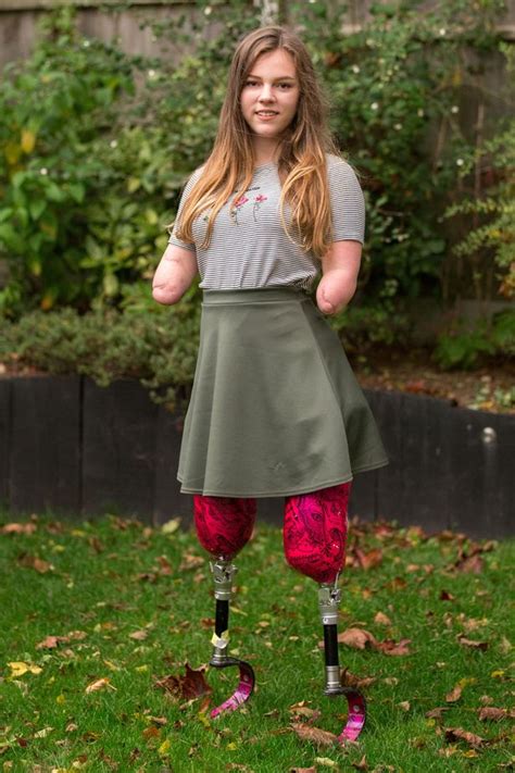 Teenage Amputee Who Lost All Four Limbs To Meningitis Wins Thousands Of