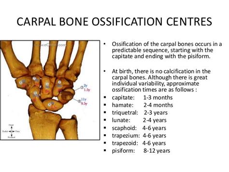 Carpal Bones Ossification Mnemonic Medicomaestro