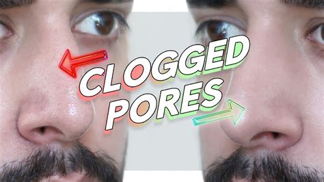 How To Unclog Pores Around Lips
