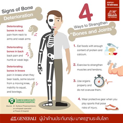 Stay Healthy With Strong Bones